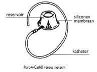 Bard catheter