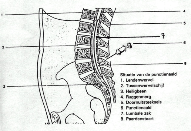 Lumbaalpunctie wervels